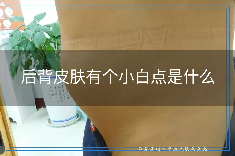 后背皮肤有个小白点是什么