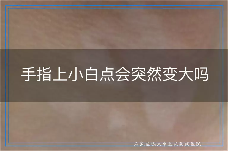 手指上小白点会突然变大吗
