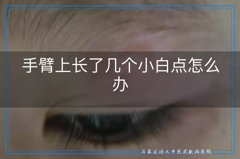 手臂上长了几个小白点怎么办
