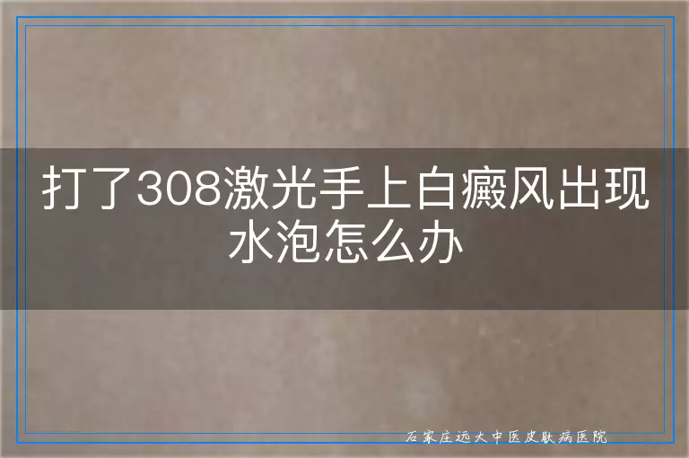打了308激光手上白癜风出现水泡怎么办
