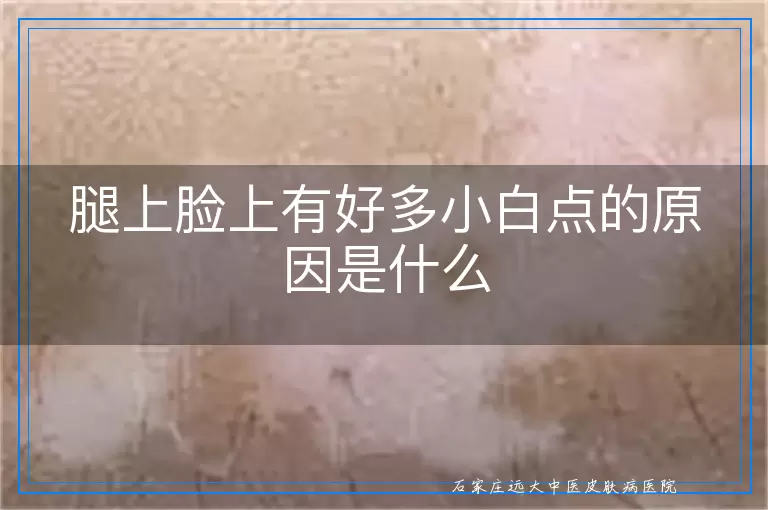 腿上脸上有好多小白点的原因是什么