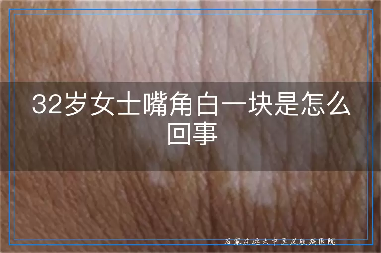 32岁女士嘴角白一块是怎么回事