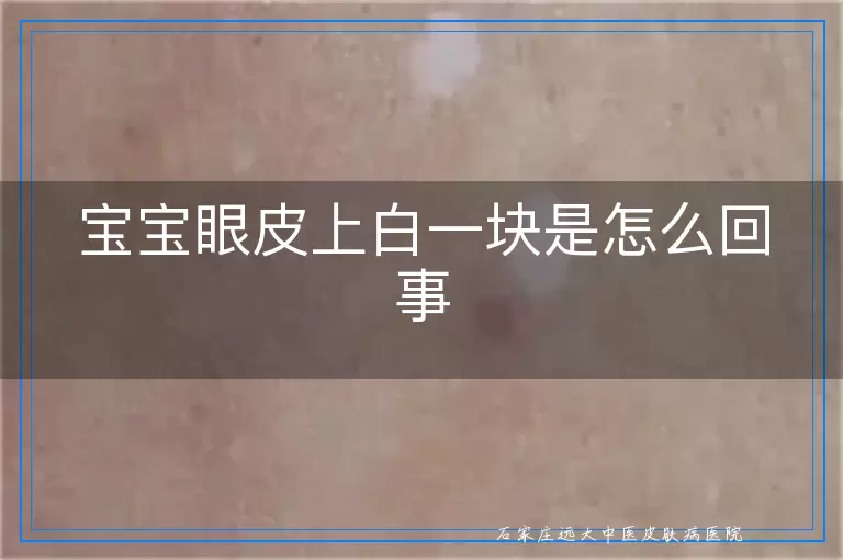 宝宝眼皮上白一块是怎么回事