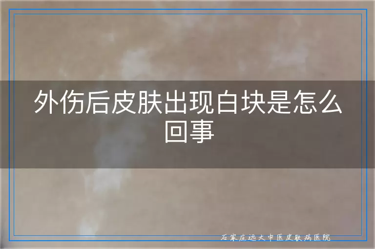 外伤后皮肤出现白块是怎么回事