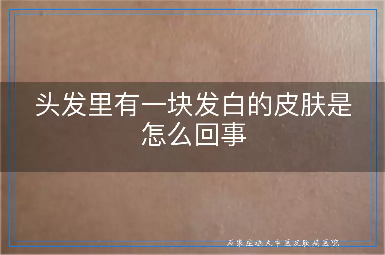 头发里有一块发白的皮肤是怎么回事