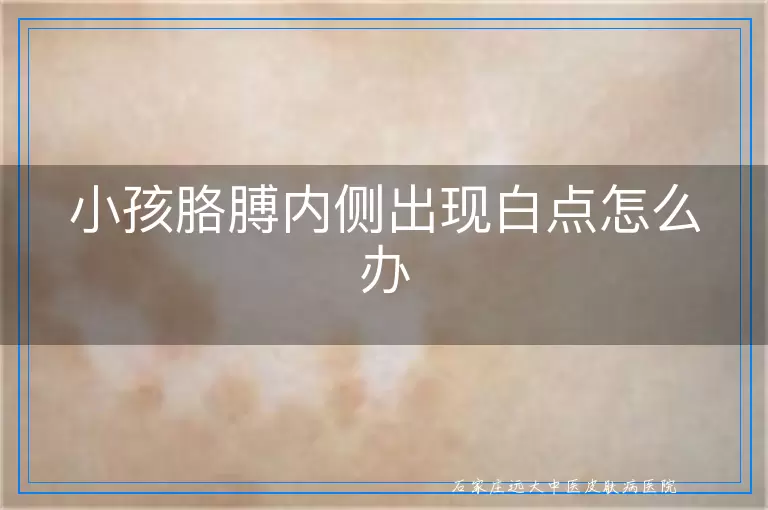 小孩胳膊内侧出现白点怎么办