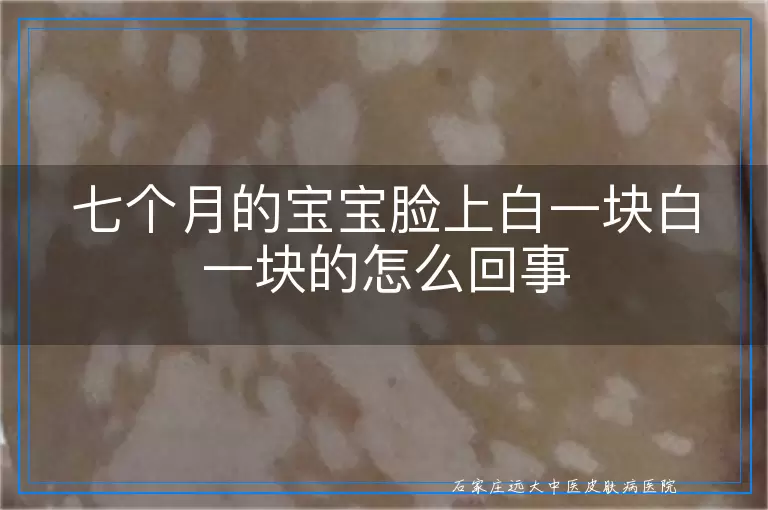 七个月的宝宝脸上白一块白一块的怎么回事