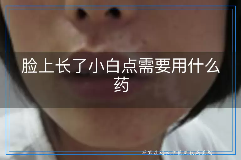 脸上长了小白点需要用什么药