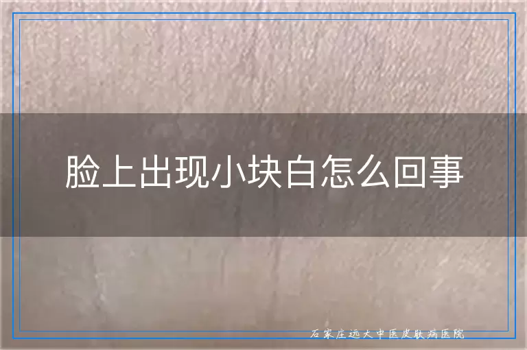 脸上出现小块白怎么回事