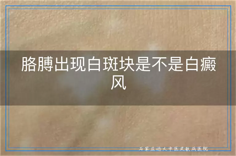 胳膊出现白斑块是不是白癜风