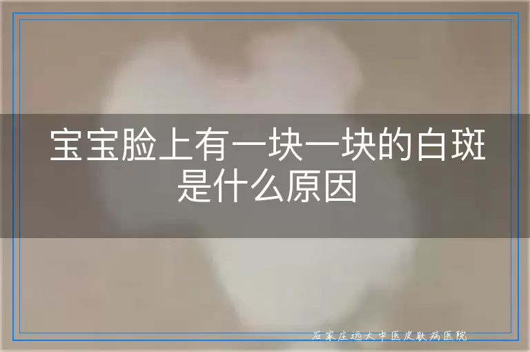 宝宝脸上有一块一块的白斑是什么原因