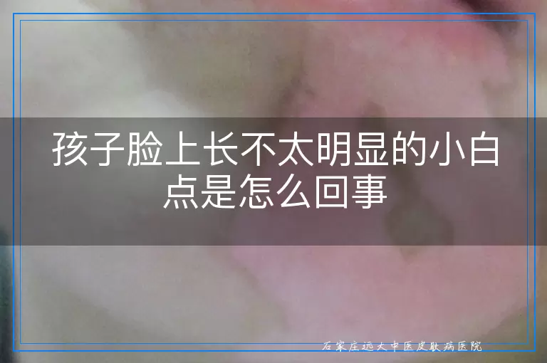 孩子脸上长不太明显的小白点是怎么回事