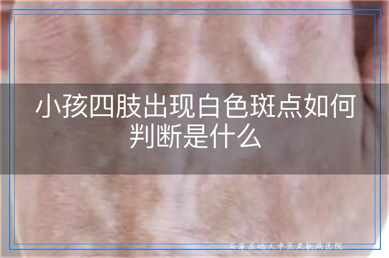 小孩四肢出现白色斑点如何判断是什么
