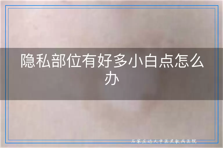 隐私部位有好多小白点怎么办