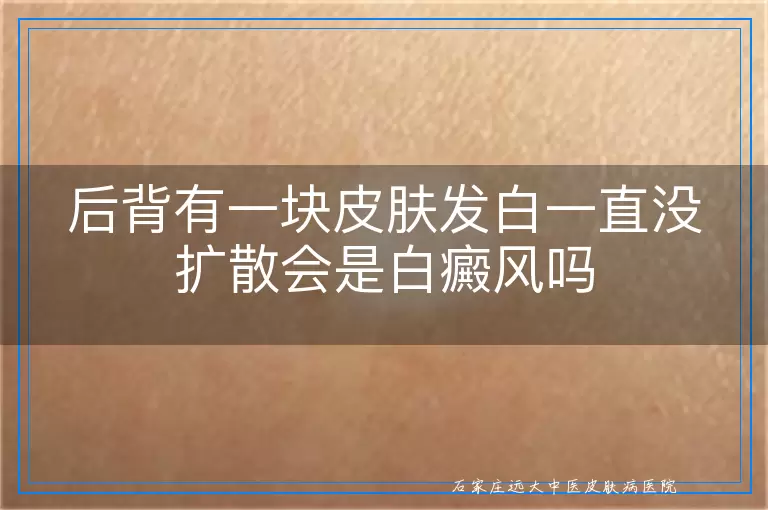 后背有一块皮肤发白一直没扩散会是白癜风吗