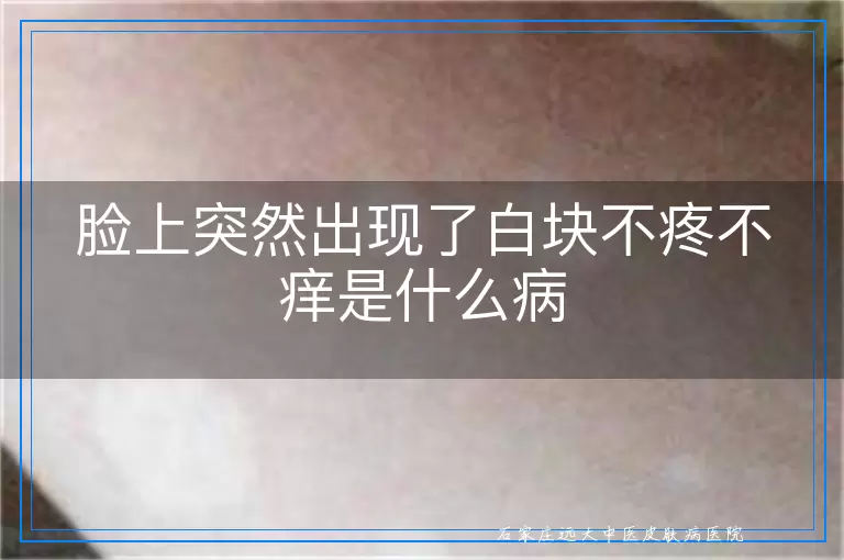 脸上突然出现了白块不疼不痒是什么病