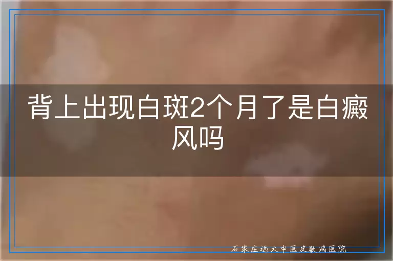 背上出现白斑2个月了是白癜风吗
