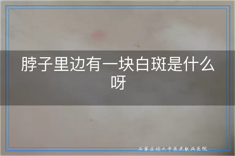 脖子里边有一块白斑是什么呀