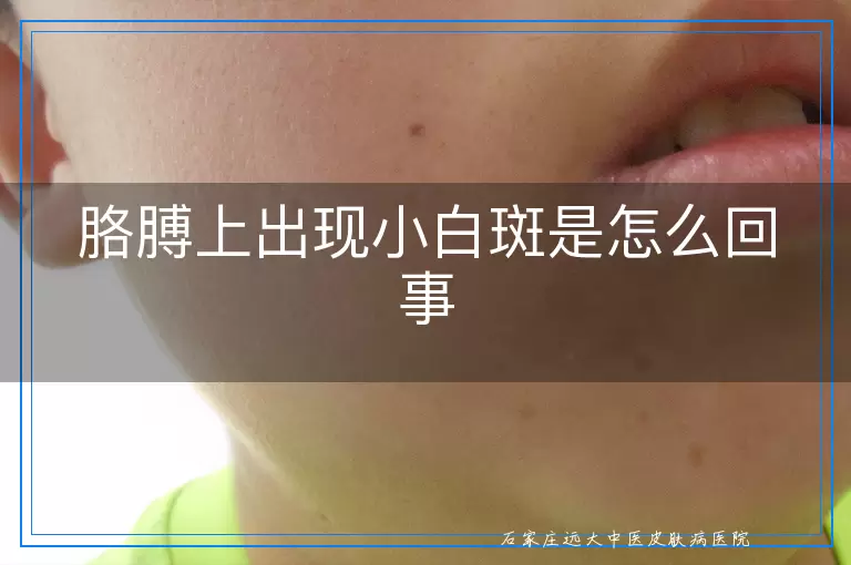 胳膊上出现小白斑是怎么回事
