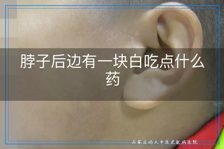 脖子后边有一块白吃点什么药