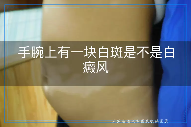 手腕上有一块白斑是不是白癜风
