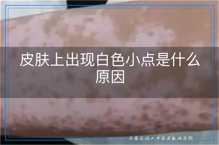 皮肤上出现白色小点是什么原因