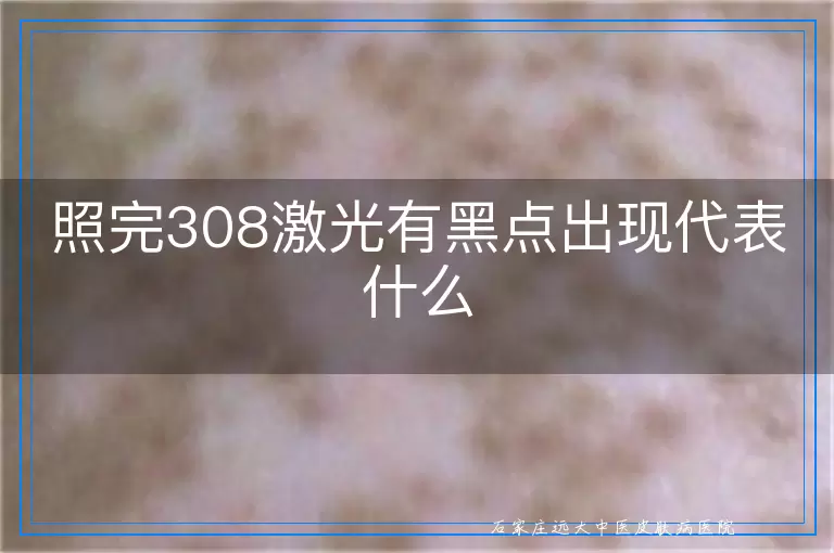 照完308激光有黑点出现代表什么