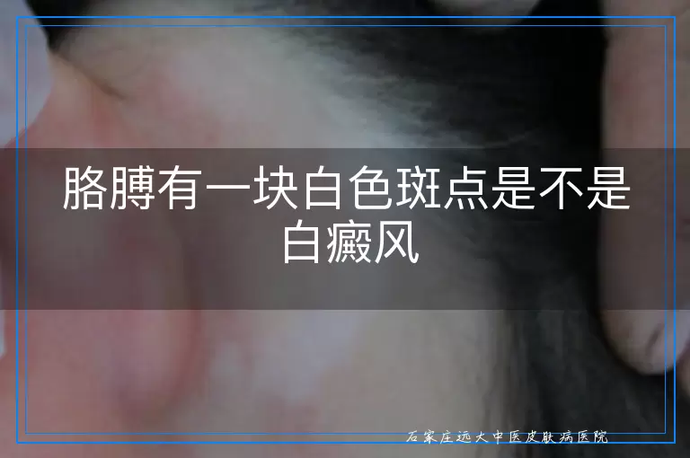 胳膊有一块白色斑点是不是白癜风