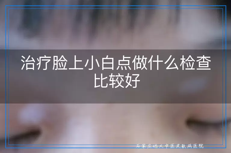 治疗脸上小白点做什么检查比较好