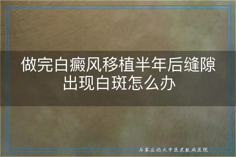 做完白癜风移植半年后缝隙出现白斑怎么办