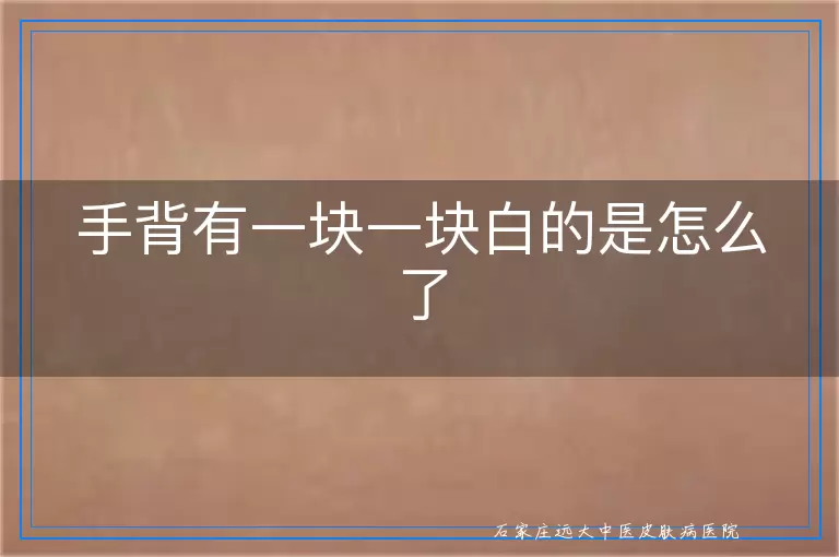 手背有一块一块白的是怎么了