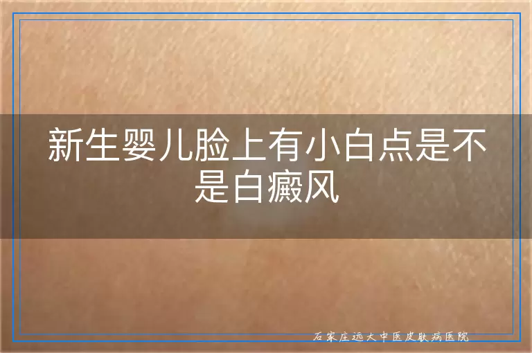 新生婴儿脸上有小白点是不是白癜风