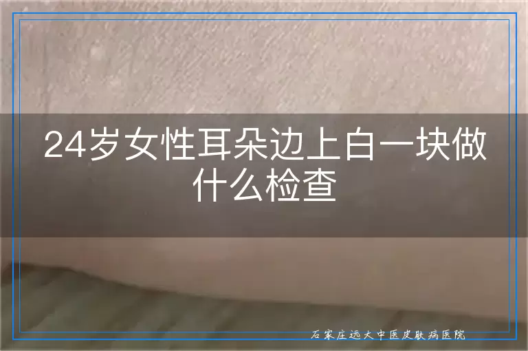 24岁女性耳朵边上白一块做什么检查