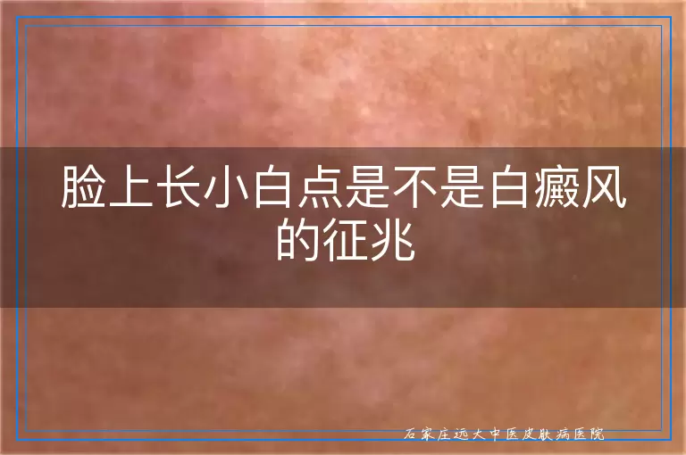 脸上长小白点是不是白癜风的征兆
