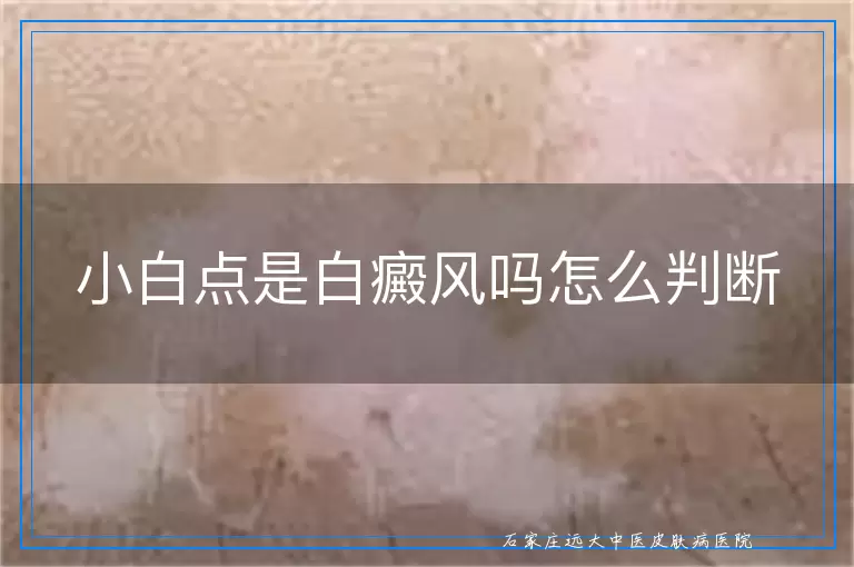 小白点是白癜风吗怎么判断