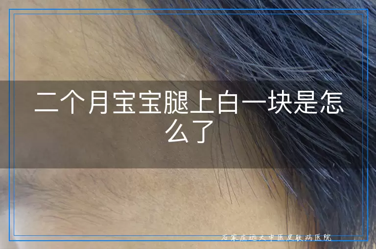 二个月宝宝腿上白一块是怎么了
