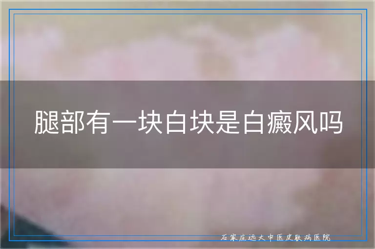 腿部有一块白块是白癜风吗