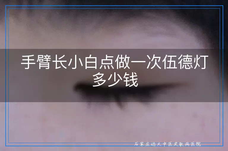 手臂长小白点做一次伍德灯多少钱