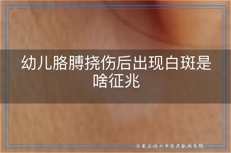 幼儿胳膊挠伤后出现白斑是啥征兆