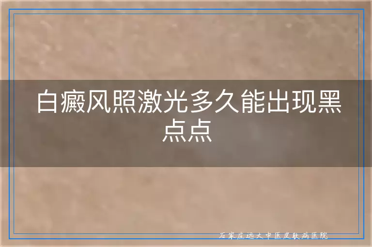 白癜风照激光多久能出现黑点点