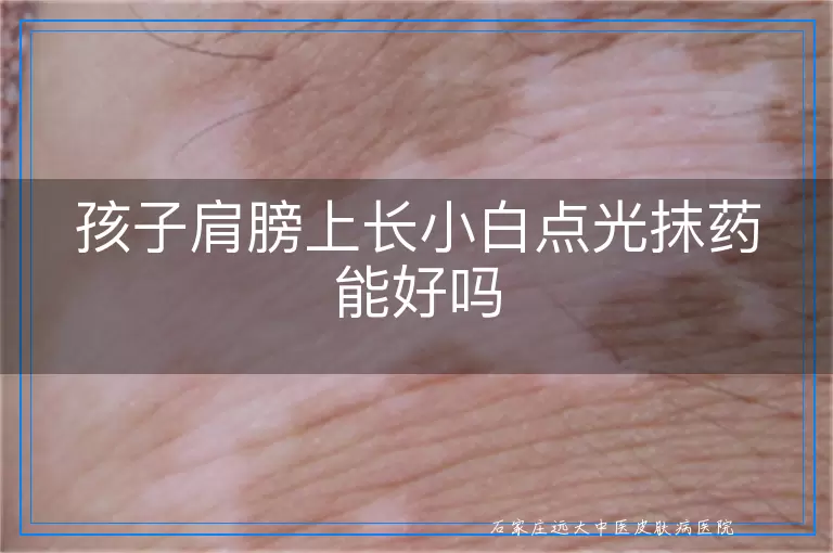 孩子肩膀上长小白点光抹药能好吗