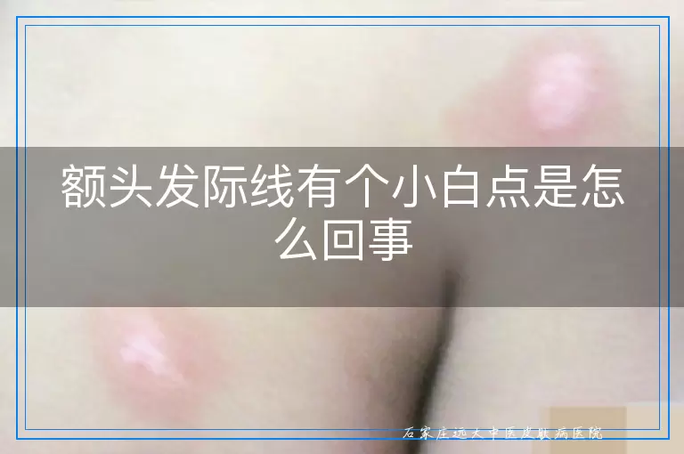 额头发际线有个小白点是怎么回事