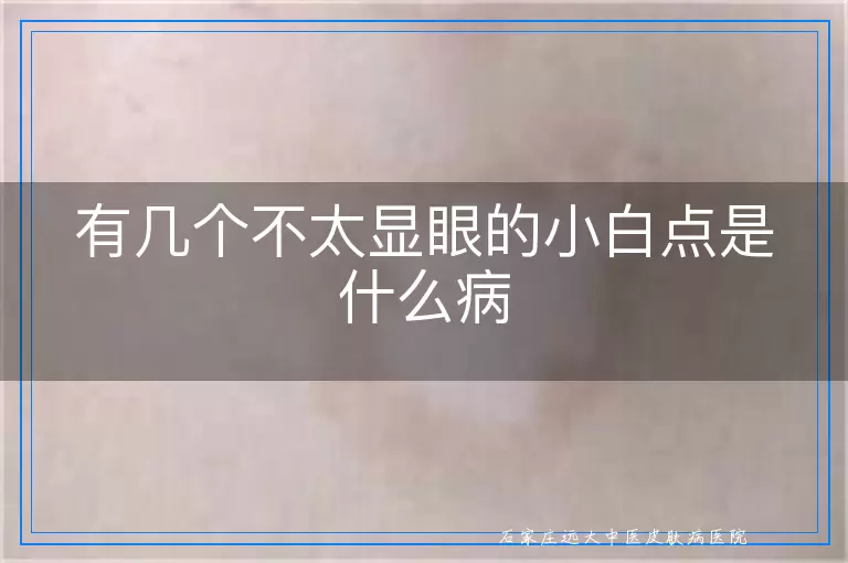 有几个不太显眼的小白点是什么病