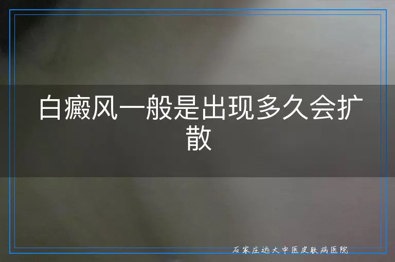 白癜风一般是出现多久会扩散