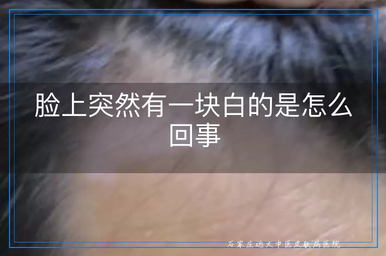脸上突然有一块白的是怎么回事