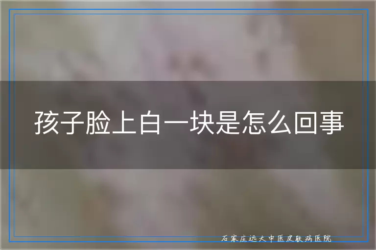 孩子脸上白一块是怎么回事