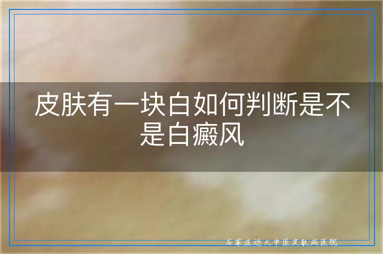 皮肤有一块白如何判断是不是白癜风