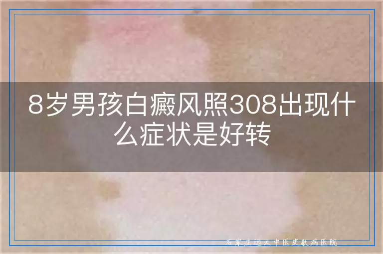 8岁男孩白癜风照308出现什么症状是好转