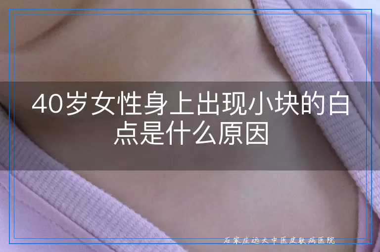 40岁女性身上出现小块的白点是什么原因