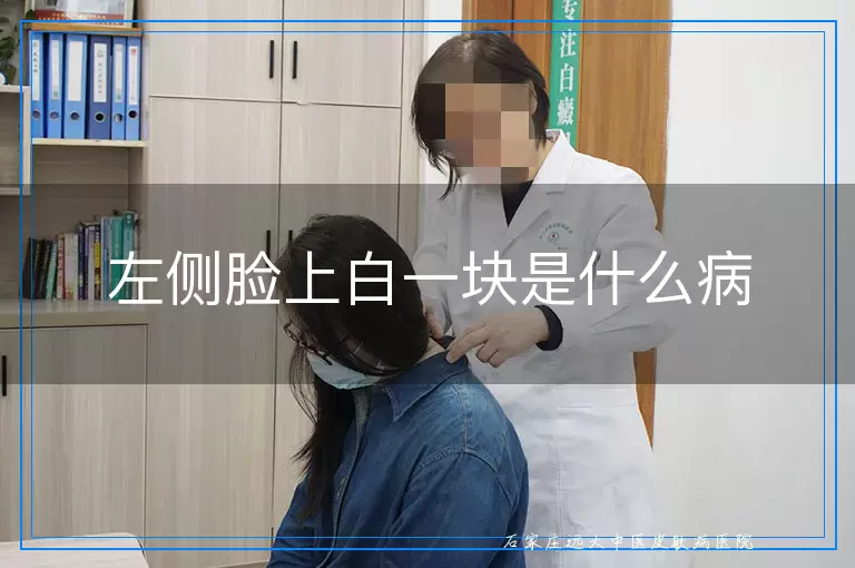 左侧脸上白一块是什么病